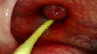 EXTREME ANAL SELF PERSPECTIVE. ONLINE CAM INSIDE HER ANUS AS I POUND HER WITH MY HUGE COCK AND SPERM DEEP INSIDE