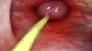 EXTREME ANAL POINT OF VIEW. WEB CAMERA INSIDE HER ANUS AS I POUND HER WITH MY HUGE ROD AND SPUNK DEEP INSIDE