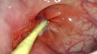 EXTREME ANAL SELF PERSPECTIVE. WEB CAMERA INSIDE HER ASS-HOLE AS I POUND HER WITH MY HUGE DONG AND JIZZ DEEP INSIDE